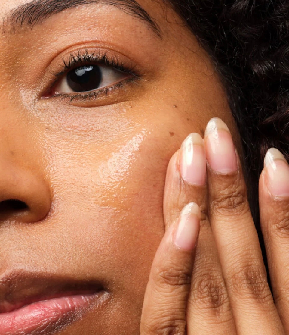 The Ordinary Niacinamide 10% + Zinc 1% (30ml)| Sérum